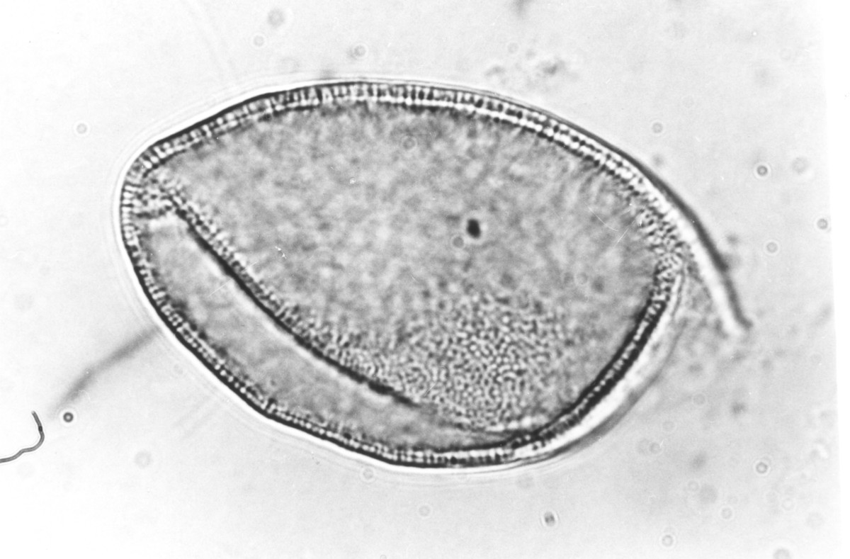 Image - Yucca filamentosa