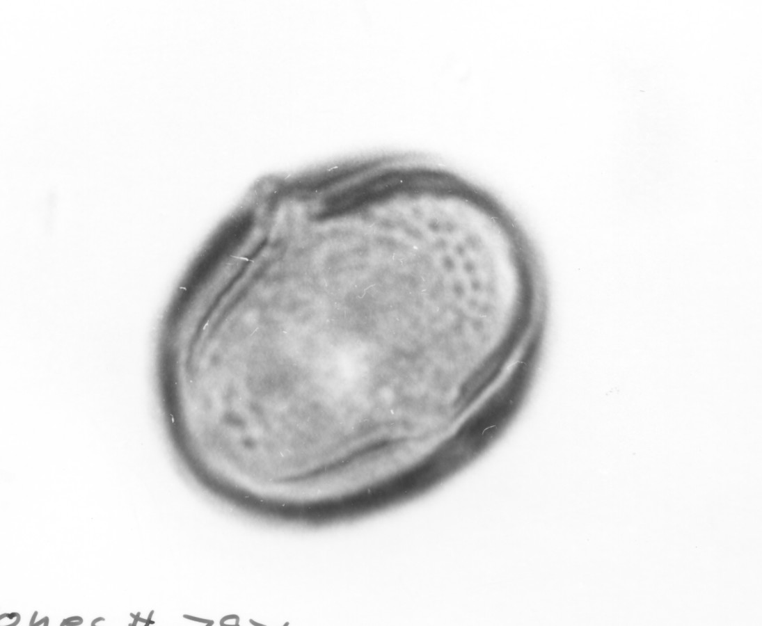 Image - Medicago minima