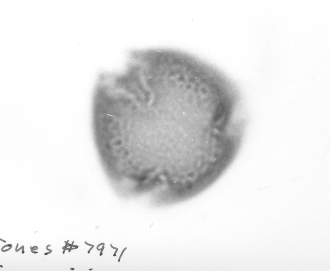 Image - Medicago minima